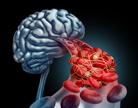 brain & blood image