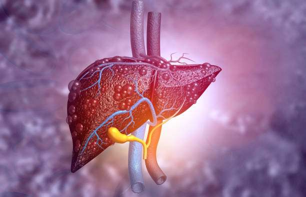inflammed liver image